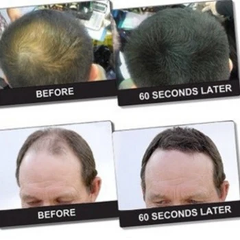Autentické Keratín Hair Vlákien Sprej 27.5 g 6 Farieb Prášok vypadávanie Vlasov Budovy Vlasová Optimalizáciu Hustý Rast Vlasov fiber powder