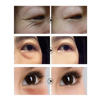LANBENA Zubov Eye Cream Eye Serum temný Kruh Anti-Aging Eye Patch na Opravu Nestarnúci Zdvíhacie Spevnenie Anti-Opuchy Starostlivosť o Pleť